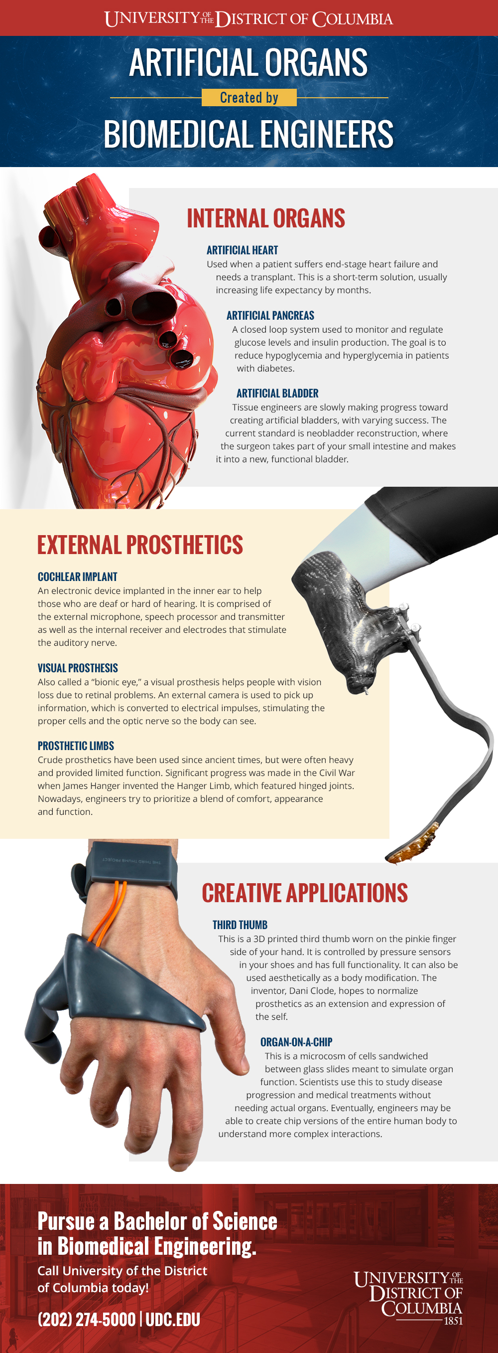 University of the District of Columbia - Infographic - Artificial Organs